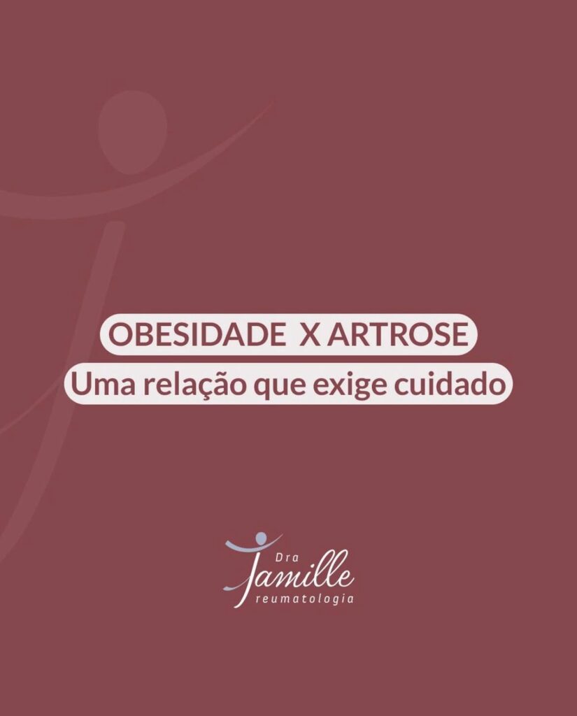 Obesidade e Artrose: uma relação que exige cuidado