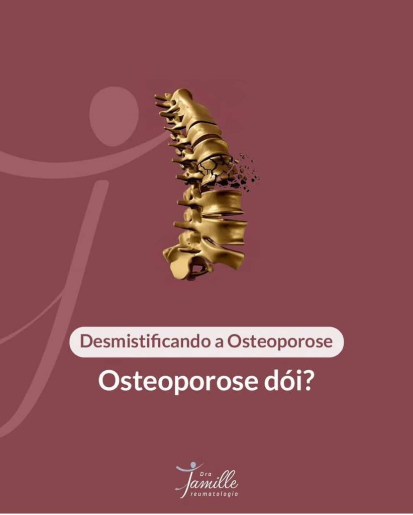 A reumatologista responde: Osteoporose dói?